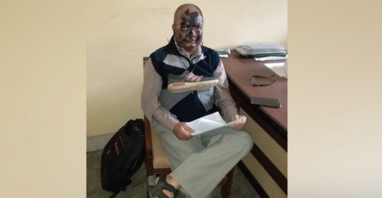 रामपुरका विद्यार्थीको हर्कत, प्राध्यापकलाई दले कालोमोसो