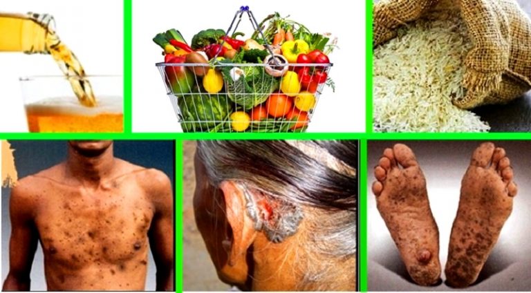 यी हुन मानवका लागि घातक विषादी, जसको प्रयोगमा सरकारले रोक लगायो